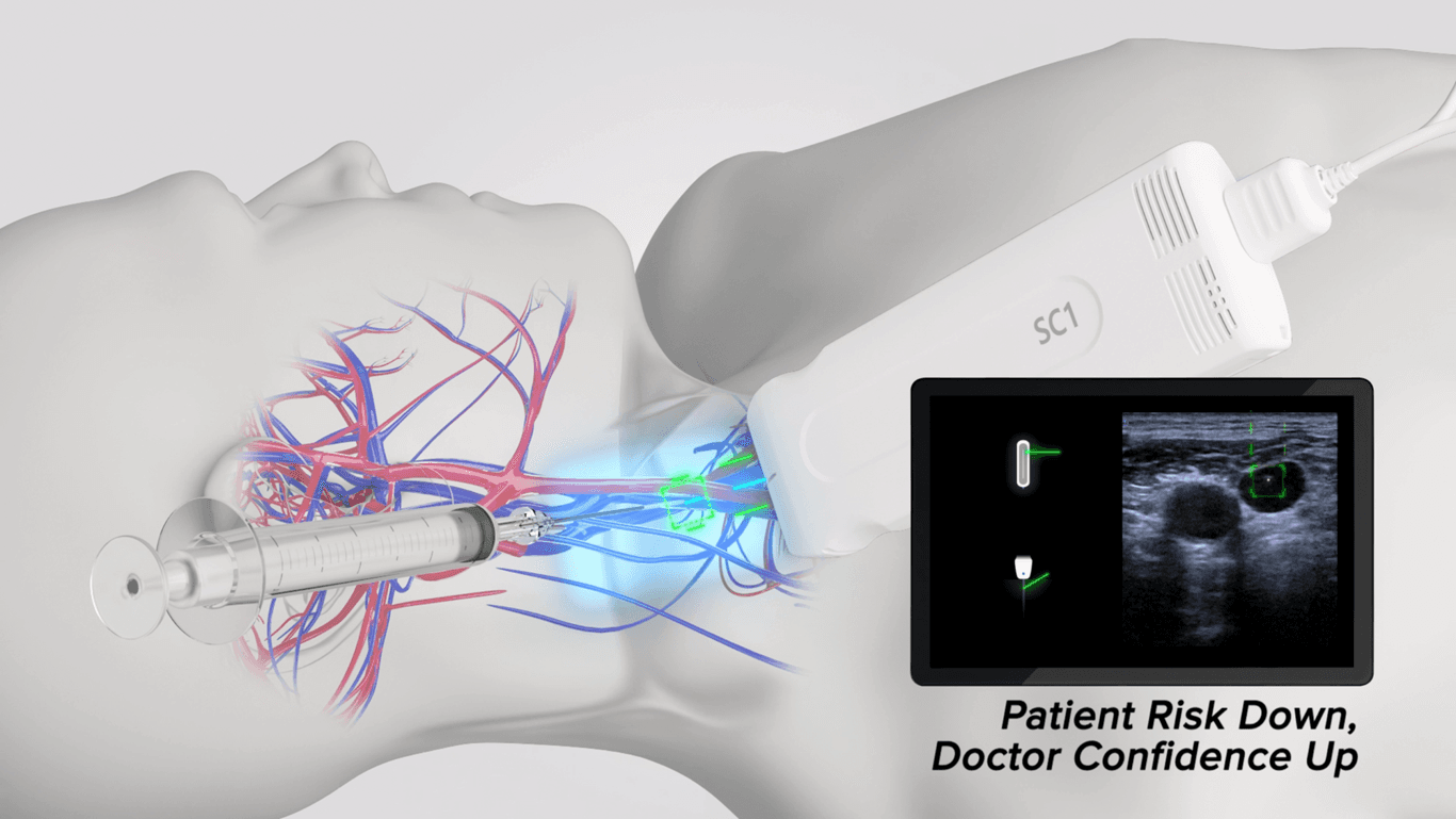 혁신적인 바늘 네비게이션 기능
