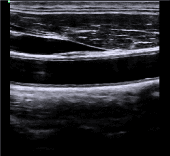 높은 품질의 초음파 이미지